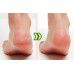 A'pieu Soft Foot 30 Minute Peeling Socks - Отшелушивающие пилинговые носочки с АНА и ВНА кислотами